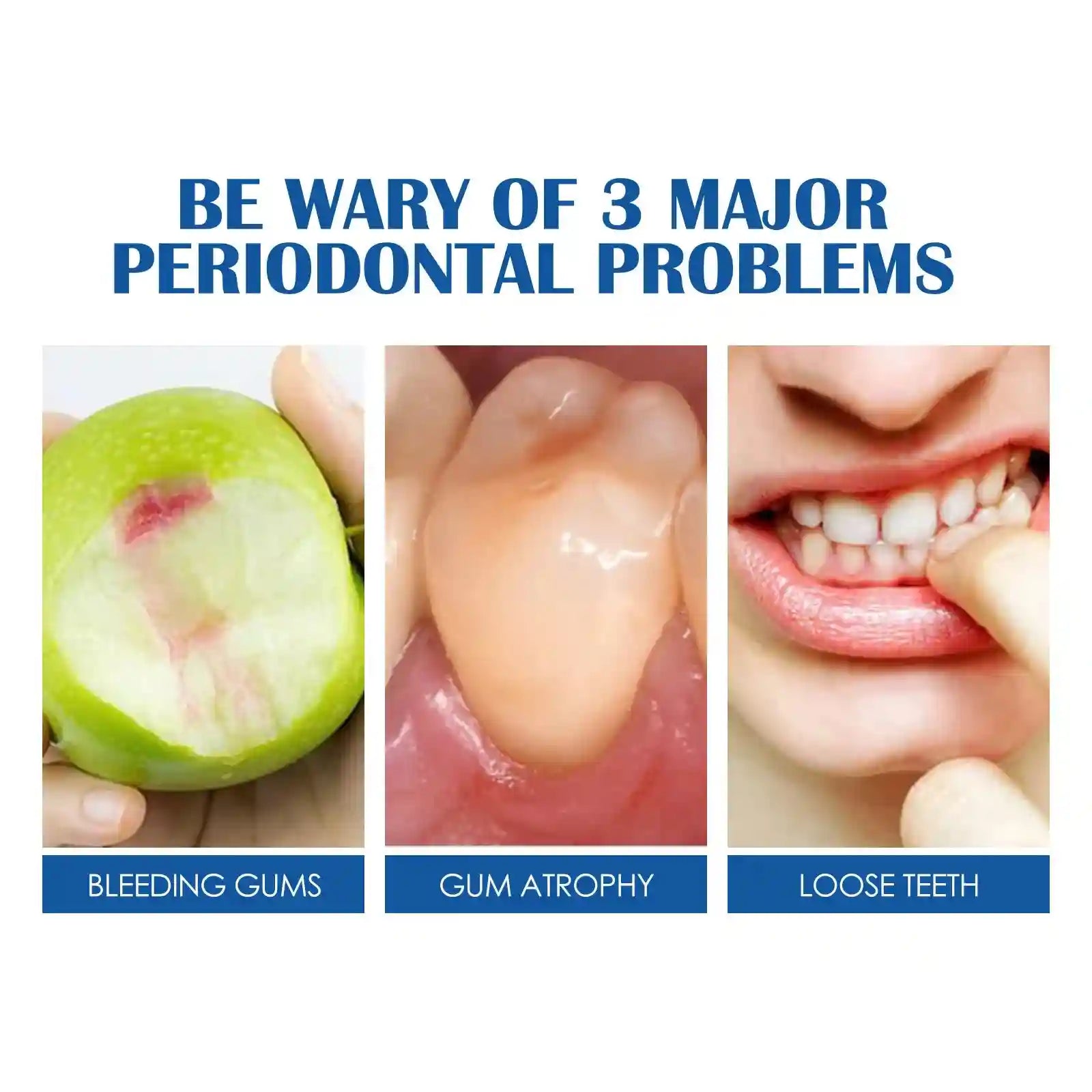 Tidesmit whitening toothpaste for removing dental plaque, tartar, smoke stains, and preventing periodontitis.