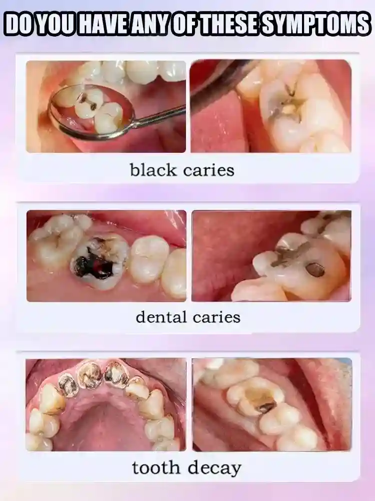 Tidesmit teeth whitening and cavity repair serum for deep enamel remineralization and natural tooth decay protection
