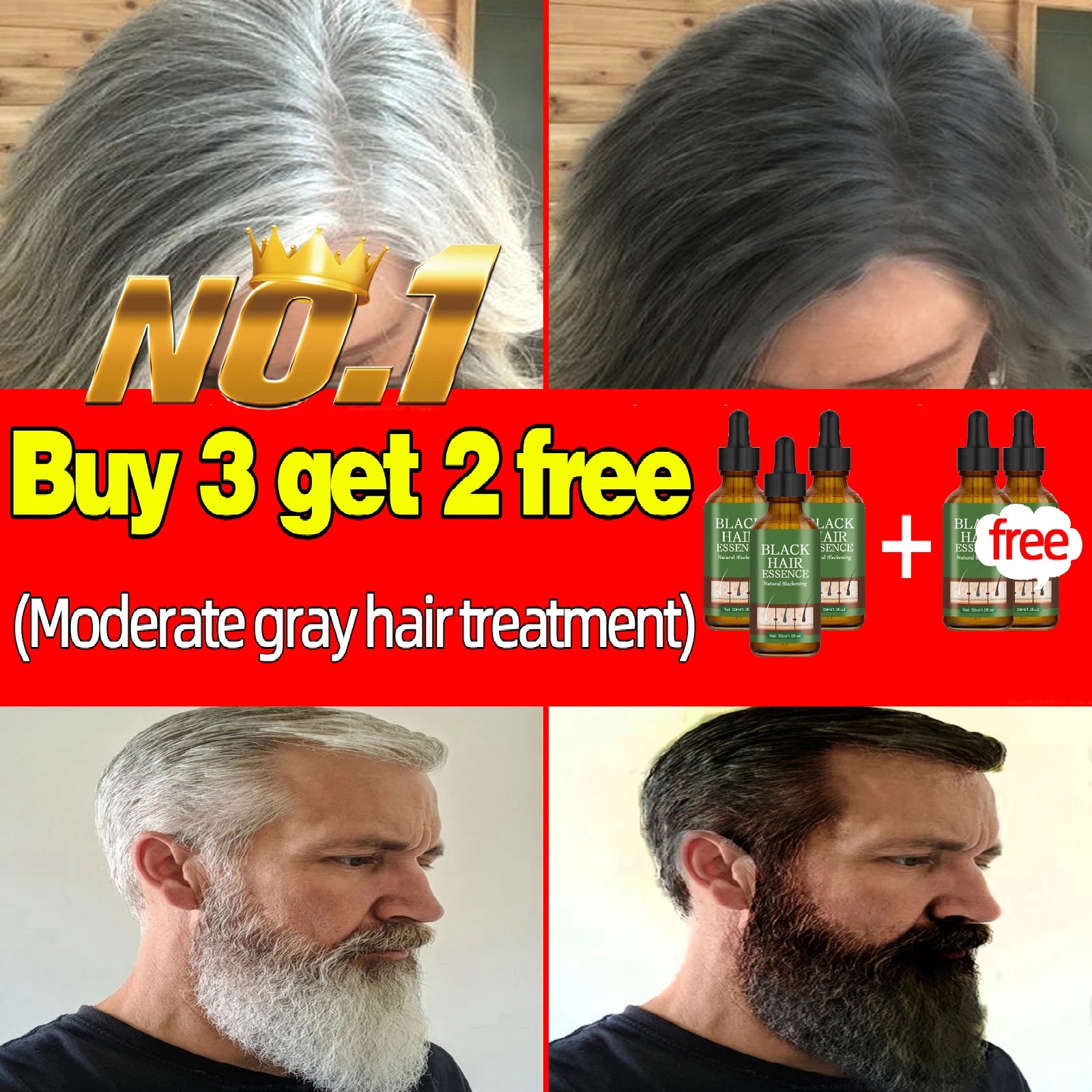 Anti Gray Hair Serum – Natural Scalp Nourishing Darkening Care Lip Care 5 pcs Tidesmit