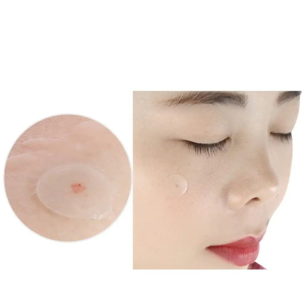 Artificial Skin Acne Removal Patch Invisible Beauty Stickers Pimple Patch Concealer Absorbing Liquid Acne Cleansing Patch