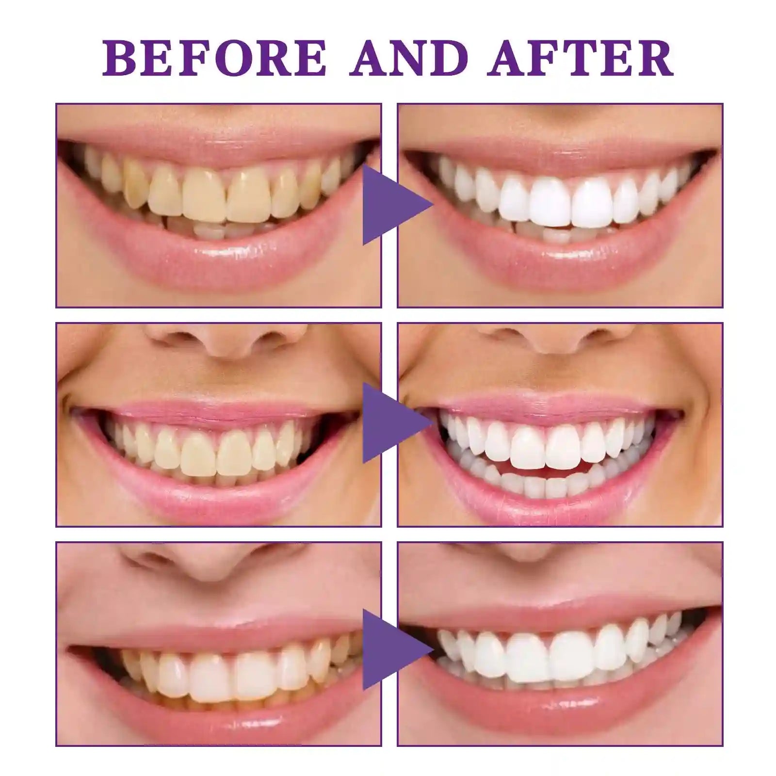 Tidesmit V34 Intensive Teeth Whitening Cleansing Mousse with gentle gum care and fresh breath pump dispenser