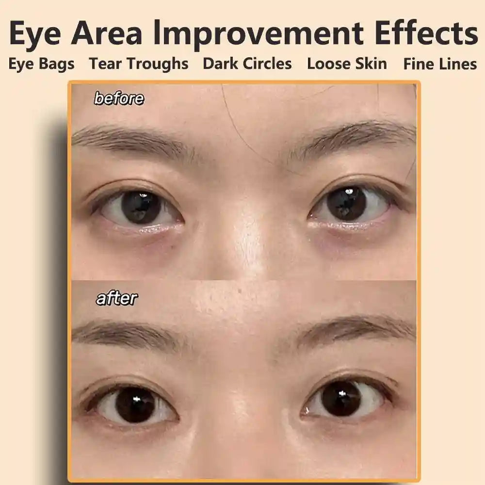 Microcurrent Eye Massager for Fatigue and Dark Circles - Rechargeable Eye Massage Instrument Tidesmit