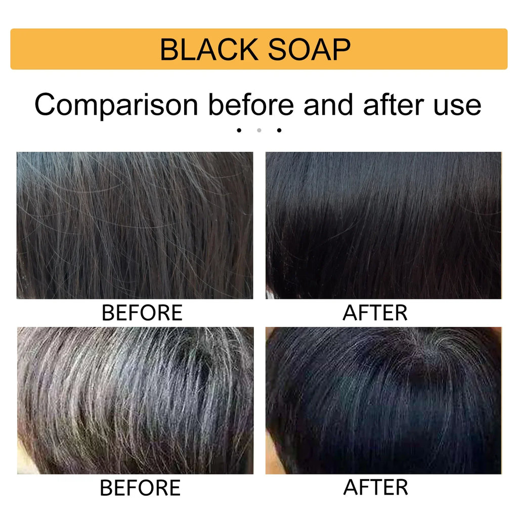 Natural Black Hair Shampoo Soap Handmade Bar With Ganoderma Polygonum Multiflorum Nourishing Shiny Hair Herbal Hair Growth Soap