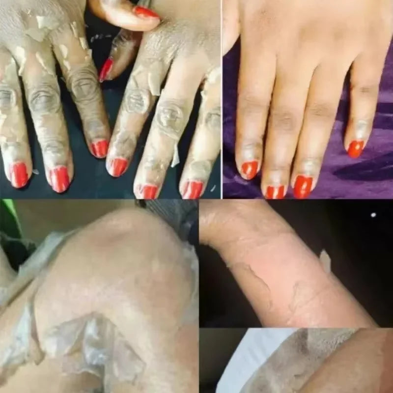 Yellow Peeling Oil for Body Exfoliation - Professional Brightening Serum Scrubs Treatments Tidesmit