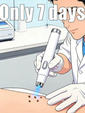 A doctor in gloves uses a slim, white handheld blue light device to treat skin tags on a patient.