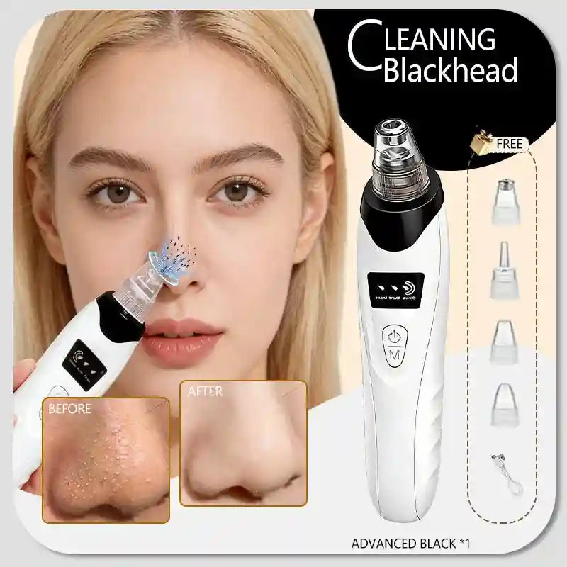 Rechargeable blackhead vacuum pore extractor with 4 suction heads for facial cleaning and oily skin treatment.