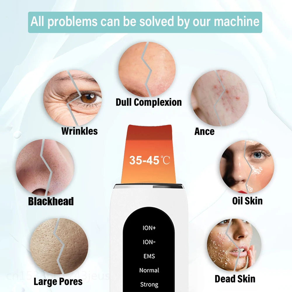 Ultrasonic Skin Scrubber – Professional Pore Cleansing Facial Tool Scrubs Treatments Tidesmit