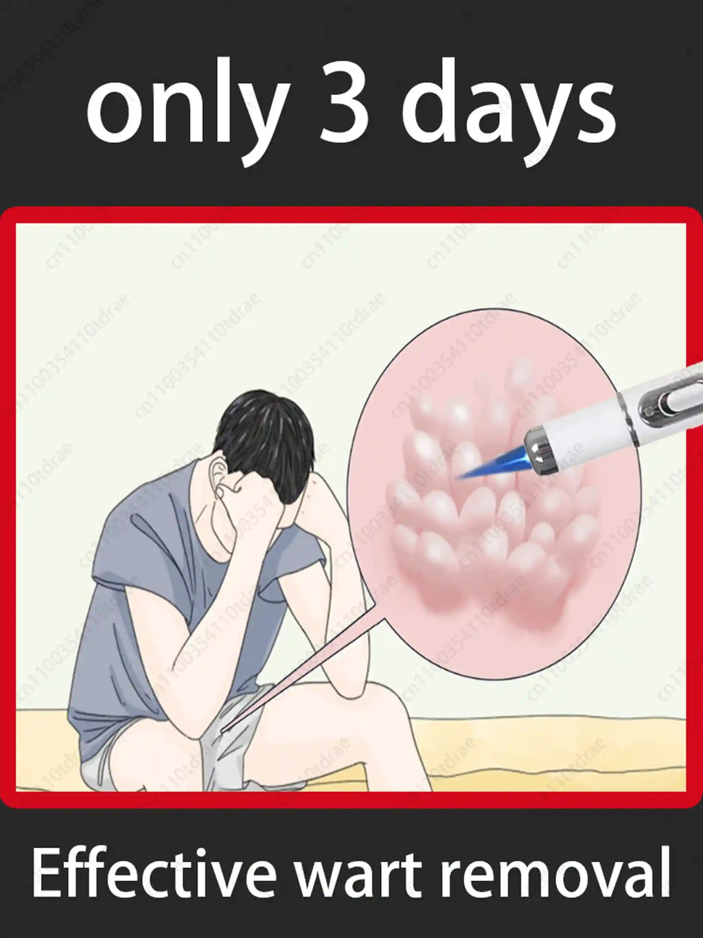 Wart Removal Roller for Home Use - Painless Fast Acting Applicator Massage Roller Buy 5 Get 5 Free Tidesmit