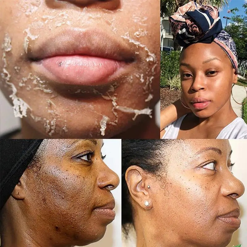 Yellow Peeling Oil for Dark Skin - 100ml Professional Exfoliating Treatment Scrubs Treatments Tidesmit