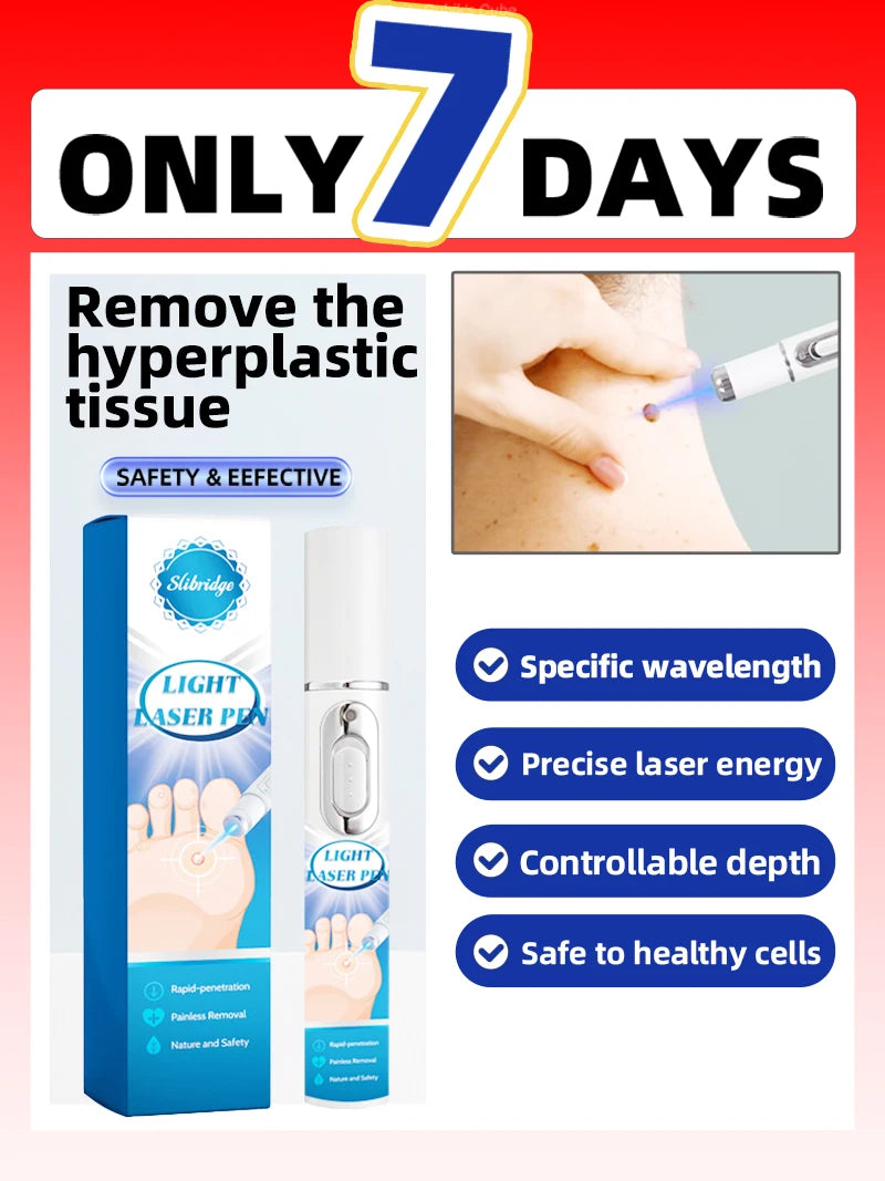 A Slibridge blue light laser pen tool for wart removal shown with its packaging and in use on skin.