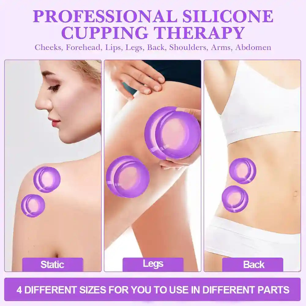 Four purple, dome-shaped silicone cupping jars of various sizes applied to a person's shoulder, leg, and abdomen.