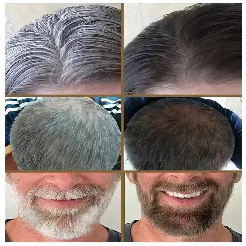 White hair killer, polygonum multiflorum shampoo soap，remove gray hair and restore natural hair color in 7 days