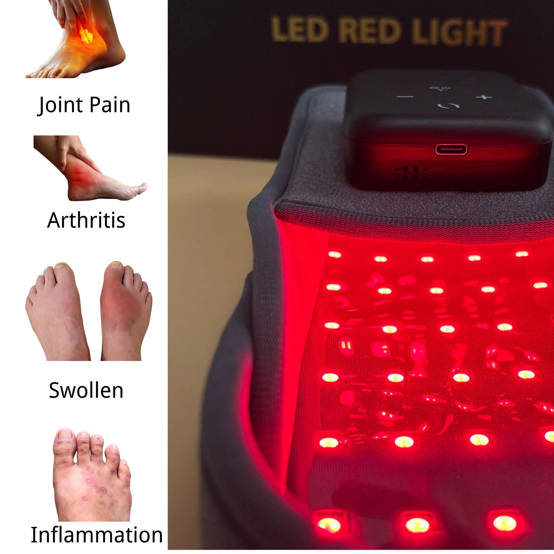 Wireless red light therapy slippers for foot pain, arthritis, and swelling with portable LED infrared technology.
