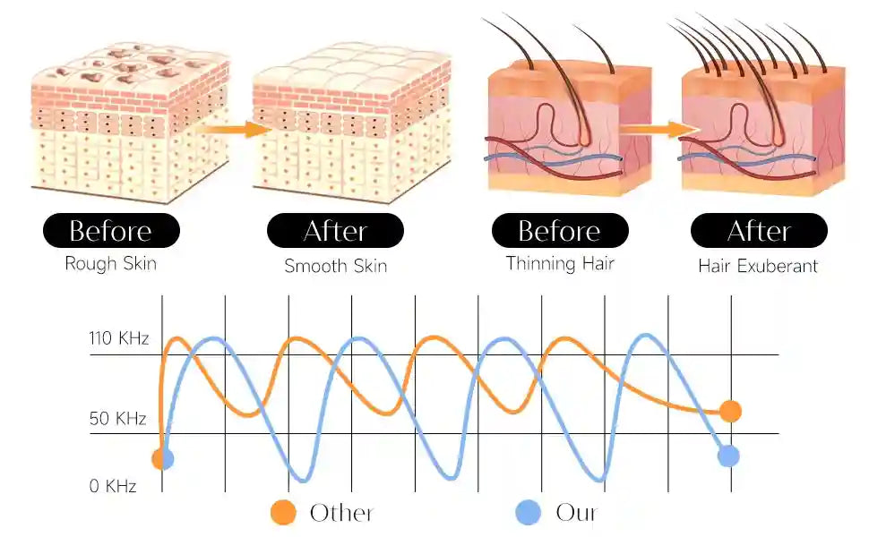 Diagram showing before/after skin and hair improvement, with a frequency wave chart comparing two devices.