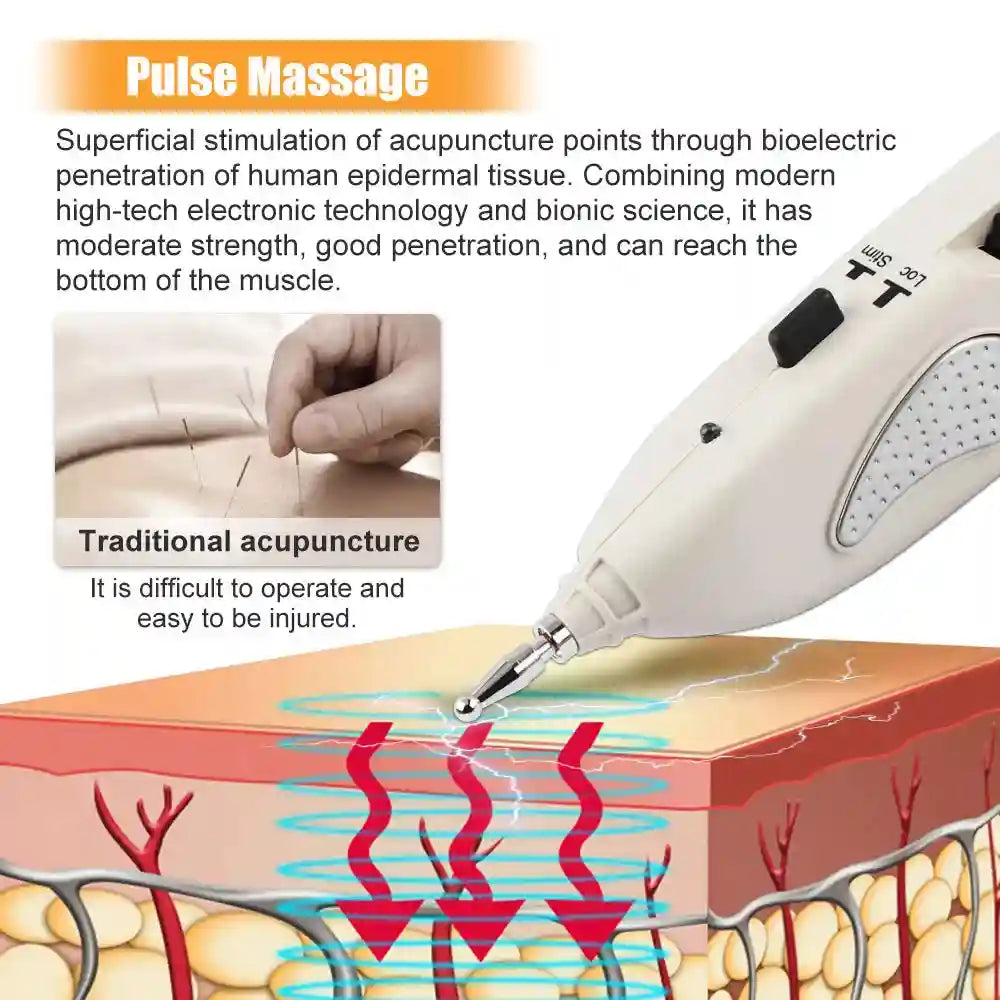 Acupuncture Pen Digital Electric Muscle Stimulator for Home Relaxation Relaxation Treatment Tidesmit