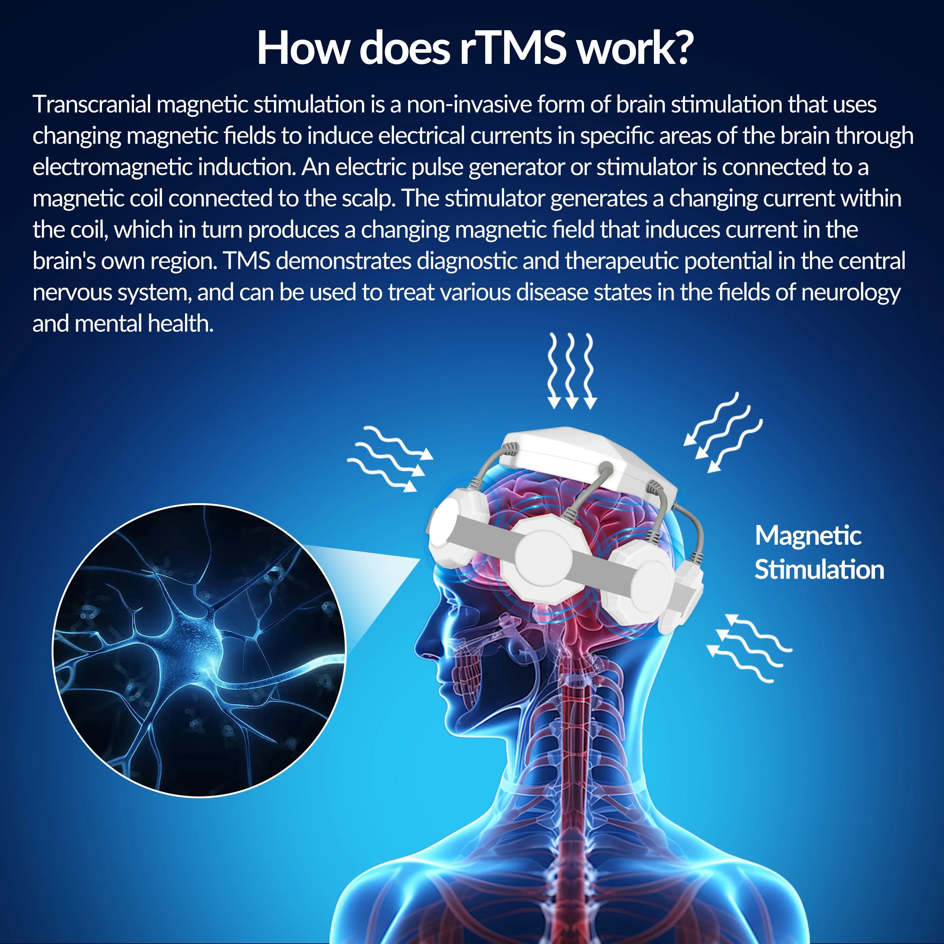 Transcranial Magnetic Stimulation Device for Anxiety Relief - Tidesmit Relaxation Treatment Tidesmit