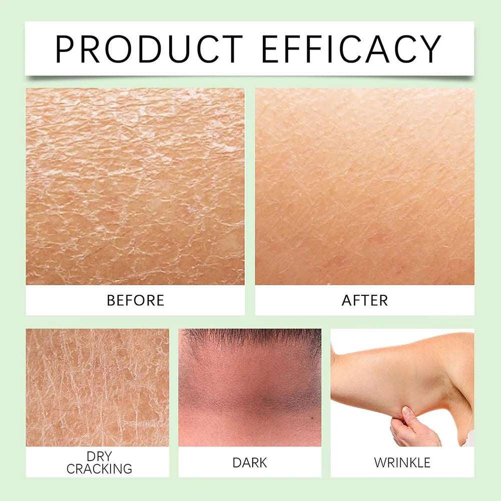 Nicotinamide Whitening Body Lotion Skin Nourishing Moisturizing Body Lotion for Dark Spot Remover Ultra-Hydrating Body Cream