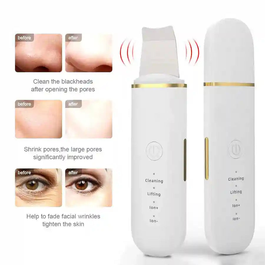 Ultrasonic Skin Scrubber Facial Pore Cleaner - Professional Grade Scrubs Treatments Tidesmit