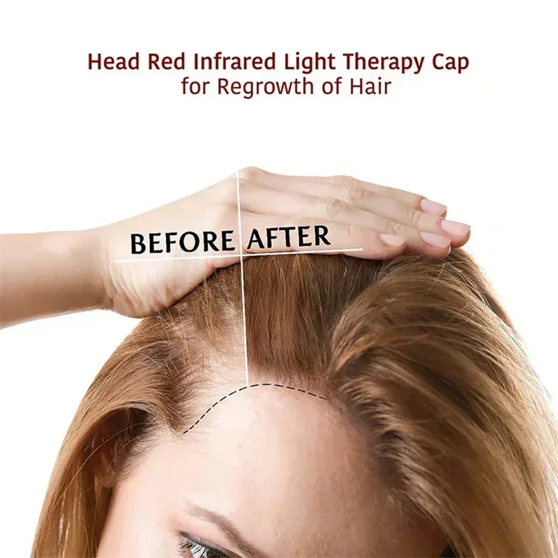 Red Light Therapy For Hair Fast Growth Cap Red&Infrared Light Therapy Device For Hair Loss Treatment With USB Charging Anti-hair