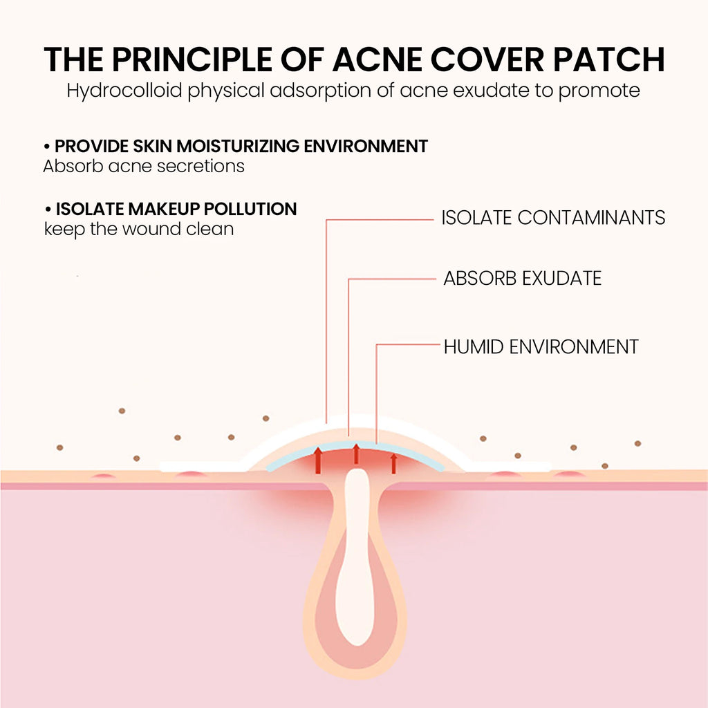 Acne Pimple Patches Sticker Repair Acne Scars Fade Blemishes Conceal Pimples Hydrocolloid Invisible Pimple Remover Tool SkinCare