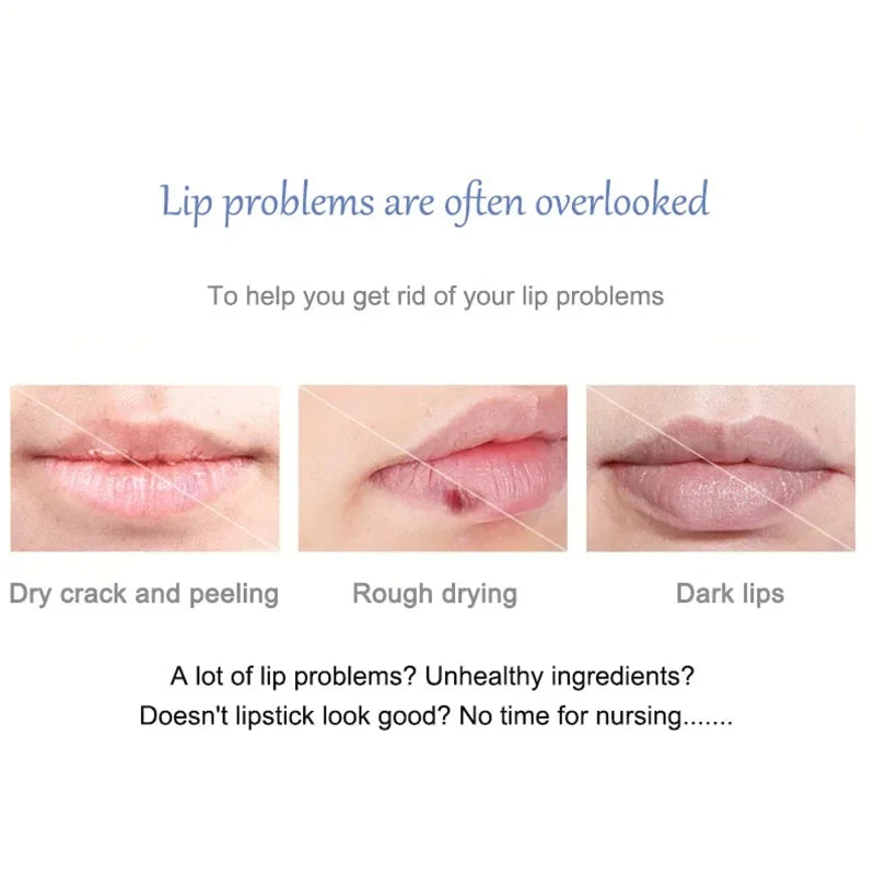 Dark Lip Lightening Balm - Exfoliating Lip Care Treatment by Tidesmit Lip Care Tidesmit