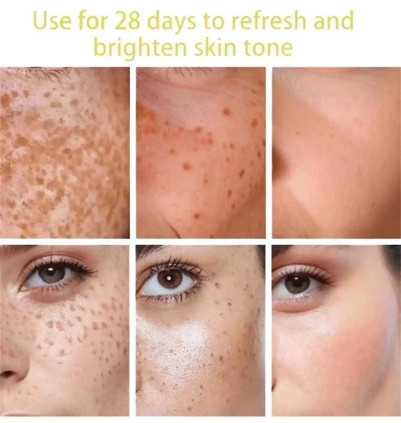 Turmeric Freckle Removing Whitening Essence Fade Pigmentation Melasma Dark Spots Corrector Repair Serum Korean Skin Care