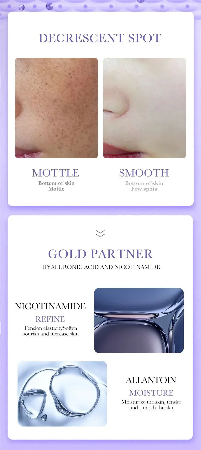 Tidesmit Mild Niacinamide Melasma Cream texture close-up for fading dark spots and brightening uneven skin tone