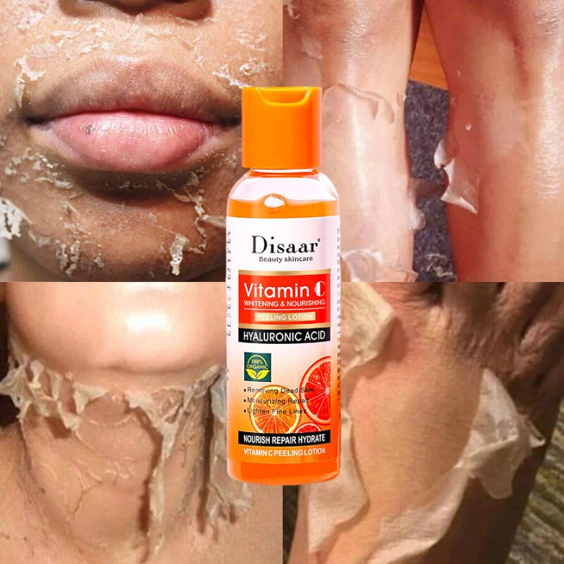 Yellow Peeling Oil for Dark Skin - 100ml Professional Exfoliating Treatment Scrubs Treatments Tidesmit