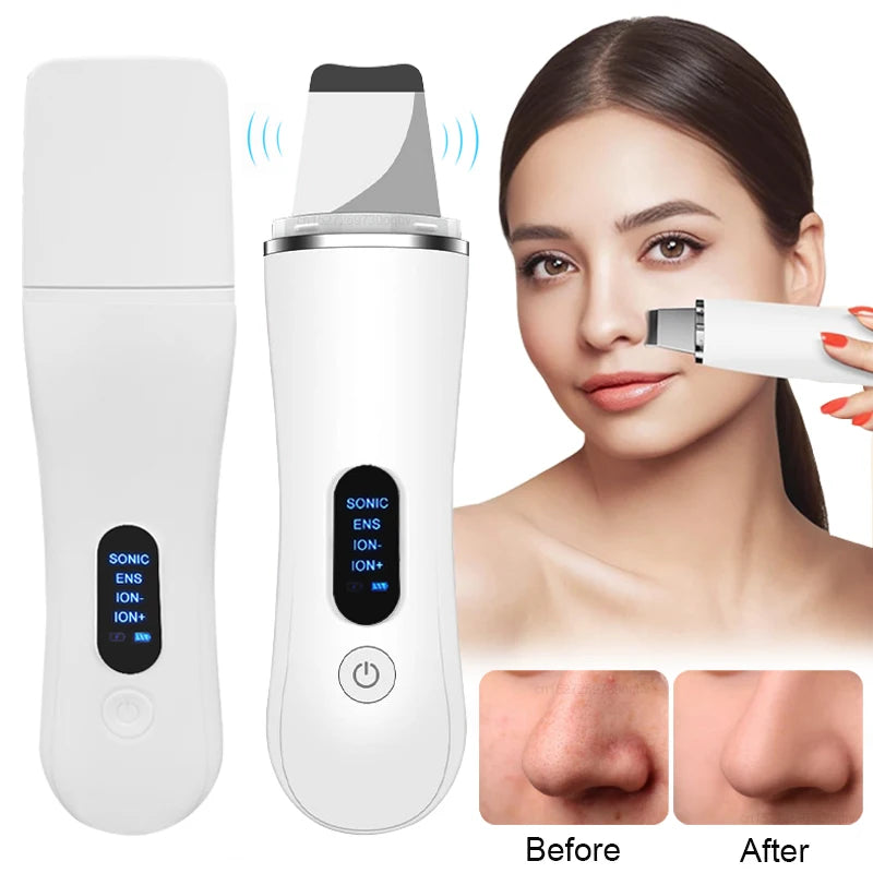 Ultrasonic Skin Scrubber Facial Cleanser - White Professional Care Scrubs Treatments Tidesmit