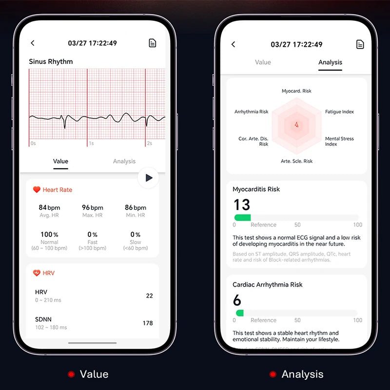 VALDUS VANTA ECG Smartwatch Man Woman SOS Fall Reminder Fitness Tracker Heart Rate Blood Pressue Sleep Monitor 2026 New Bracelet