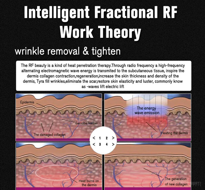 Diagram explaining fractional RF skin rejuvenation for wrinkle removal and collagen regeneration via heat therapy.