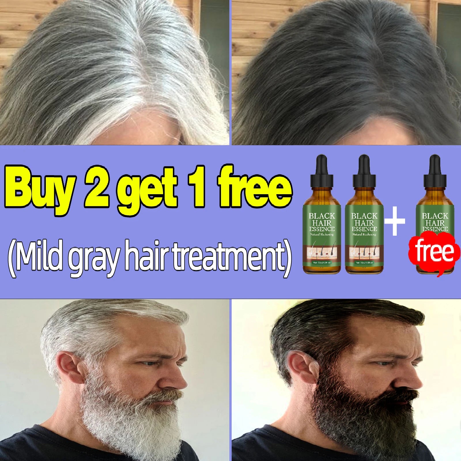 Anti Gray Hair Serum – Natural Scalp Nourishing Darkening Care Lip Care 3 pcs Tidesmit