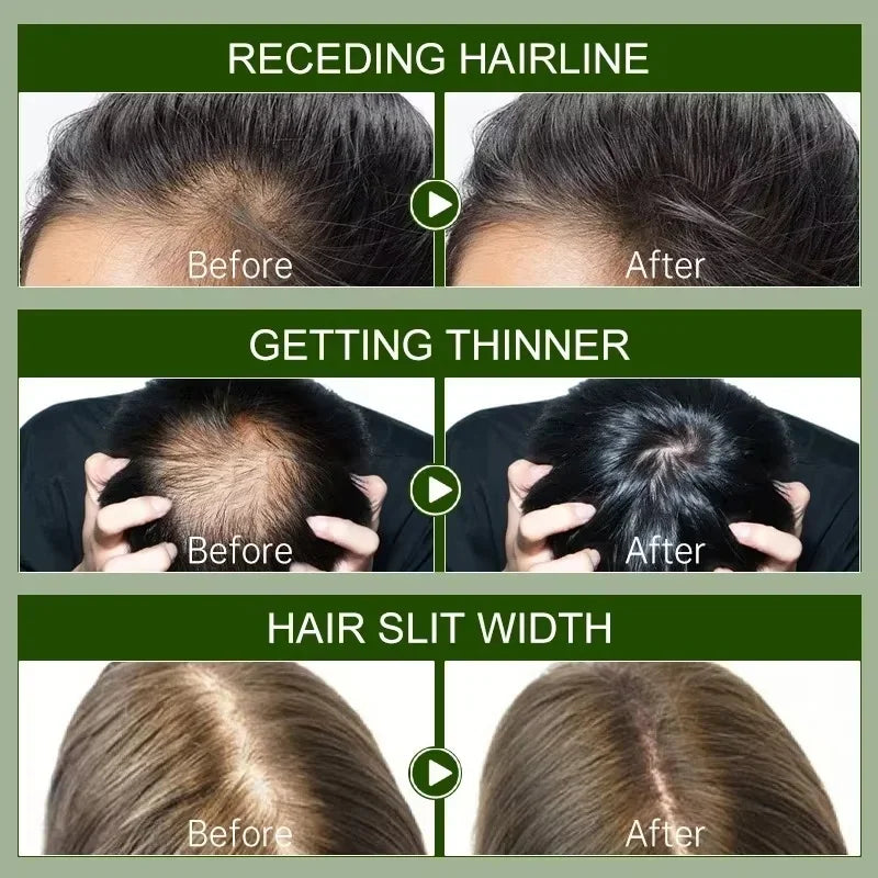 Tidesmit hair growth serum before and after results for thinning hair, scalp treatment, and fast regrowth for women.
