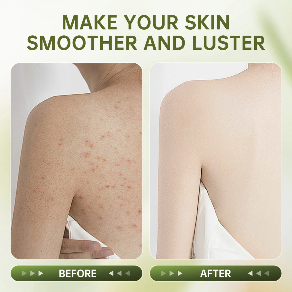 Body Scrub Exfoliant 250ml – Professional Smoothing Skin Care Scrubs Treatments Tidesmit