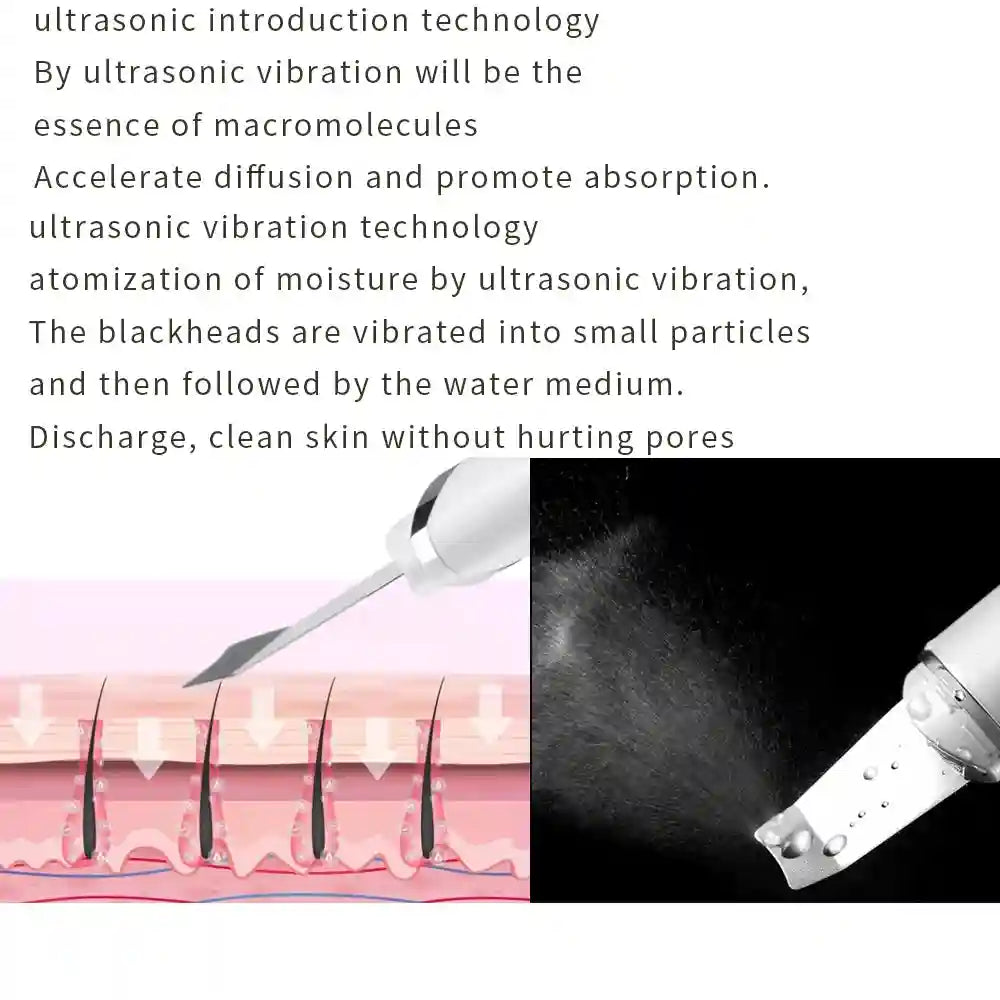 RF Skin Tightener Facial Massager | Ultrasonic Wrinkle Tool with Heat Eye Massage Instrument Tidesmit