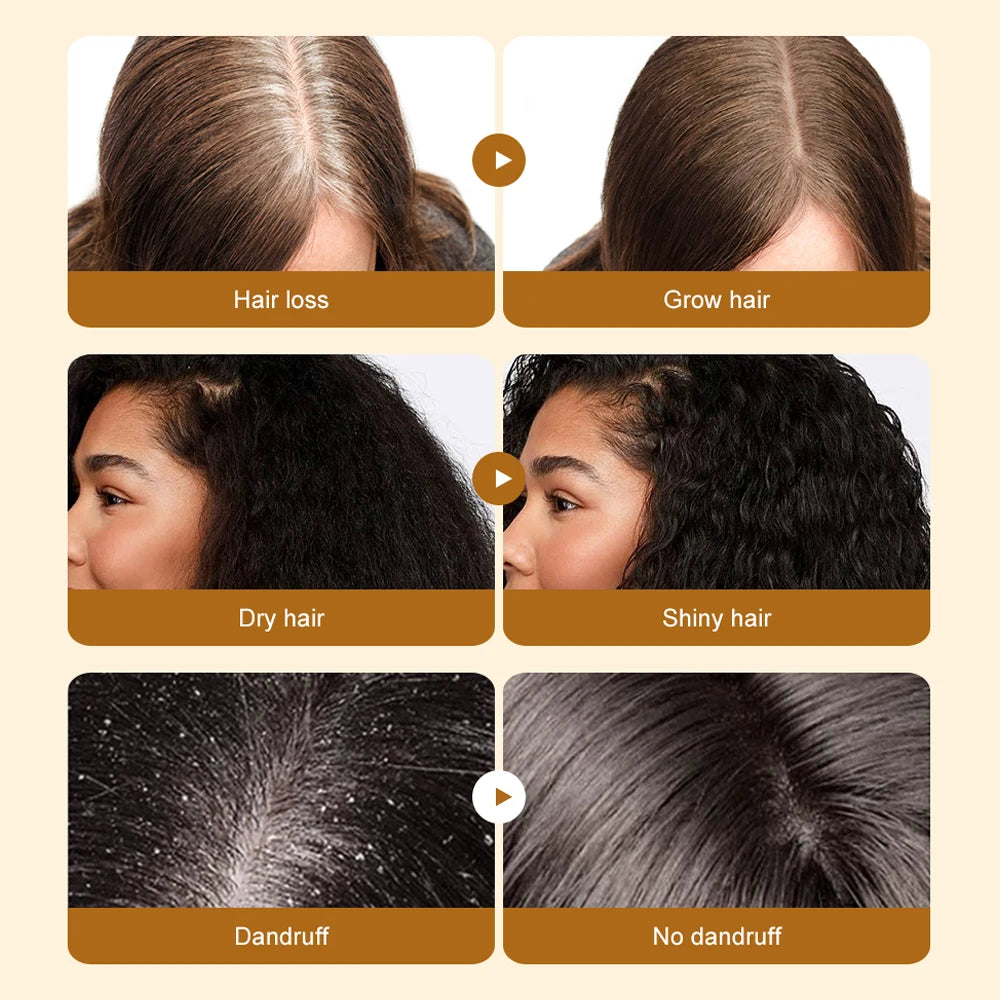 Tidesmit Natural Batana Oil hair mask: before and after results for hair growth, repair, and dandruff relief.