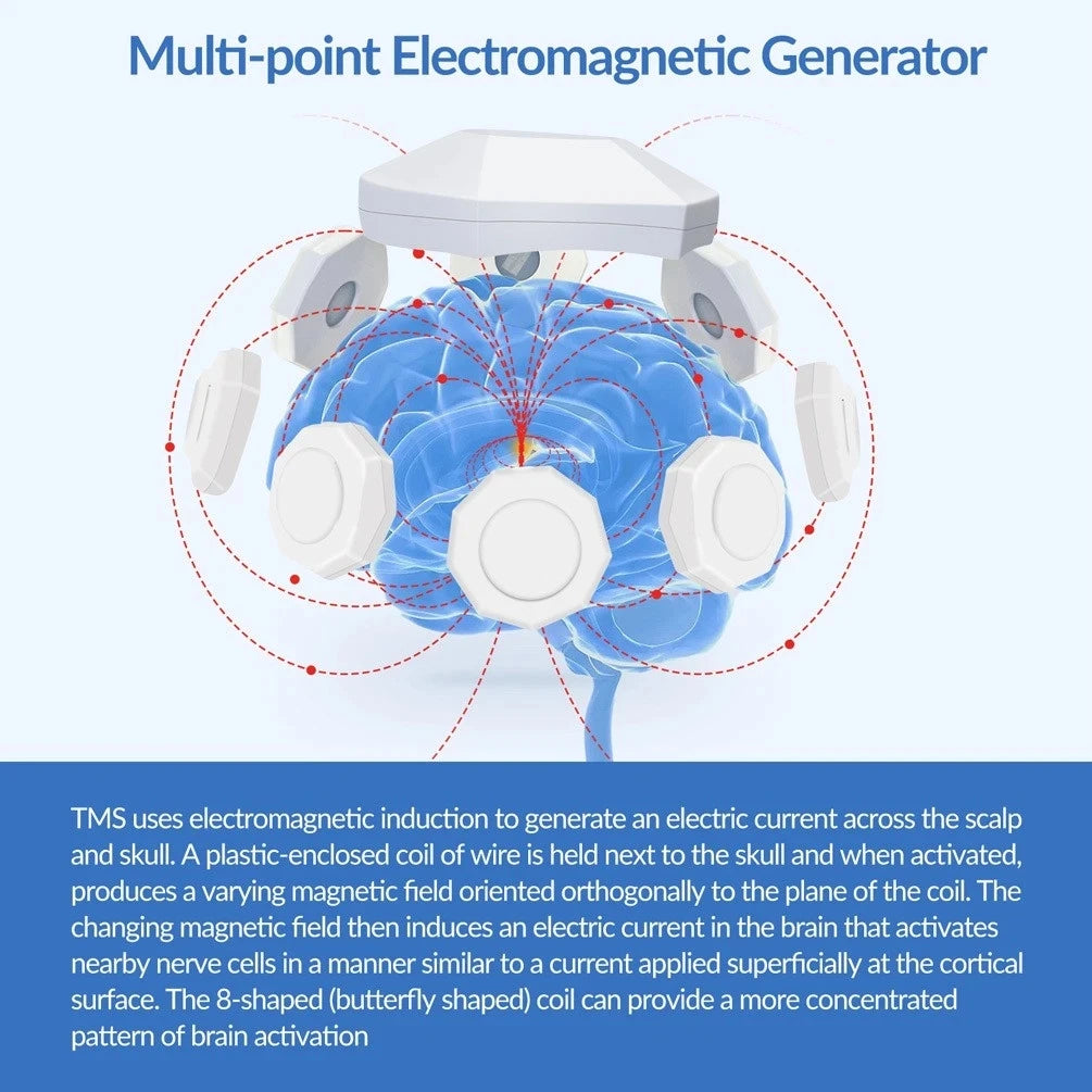 GOVW multi-point electromagnetic rTMS device showing white sensors around a human brain for non-invasive brain therapy.