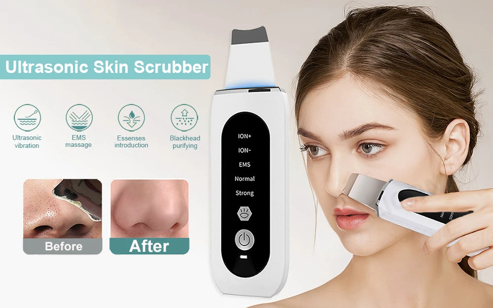 Ultrasonic Skin Scrubber – Professional Pore Cleansing Facial Tool Scrubs Treatments Tidesmit