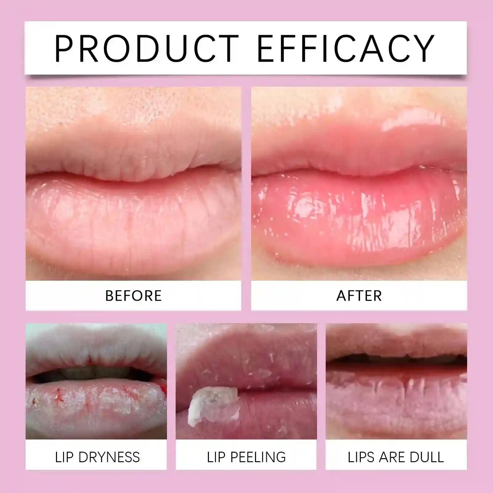 Lip Plumping Serum: Hydrating Anti-Wrinkle Treatment by Tidesmit Lip Care Tidesmit