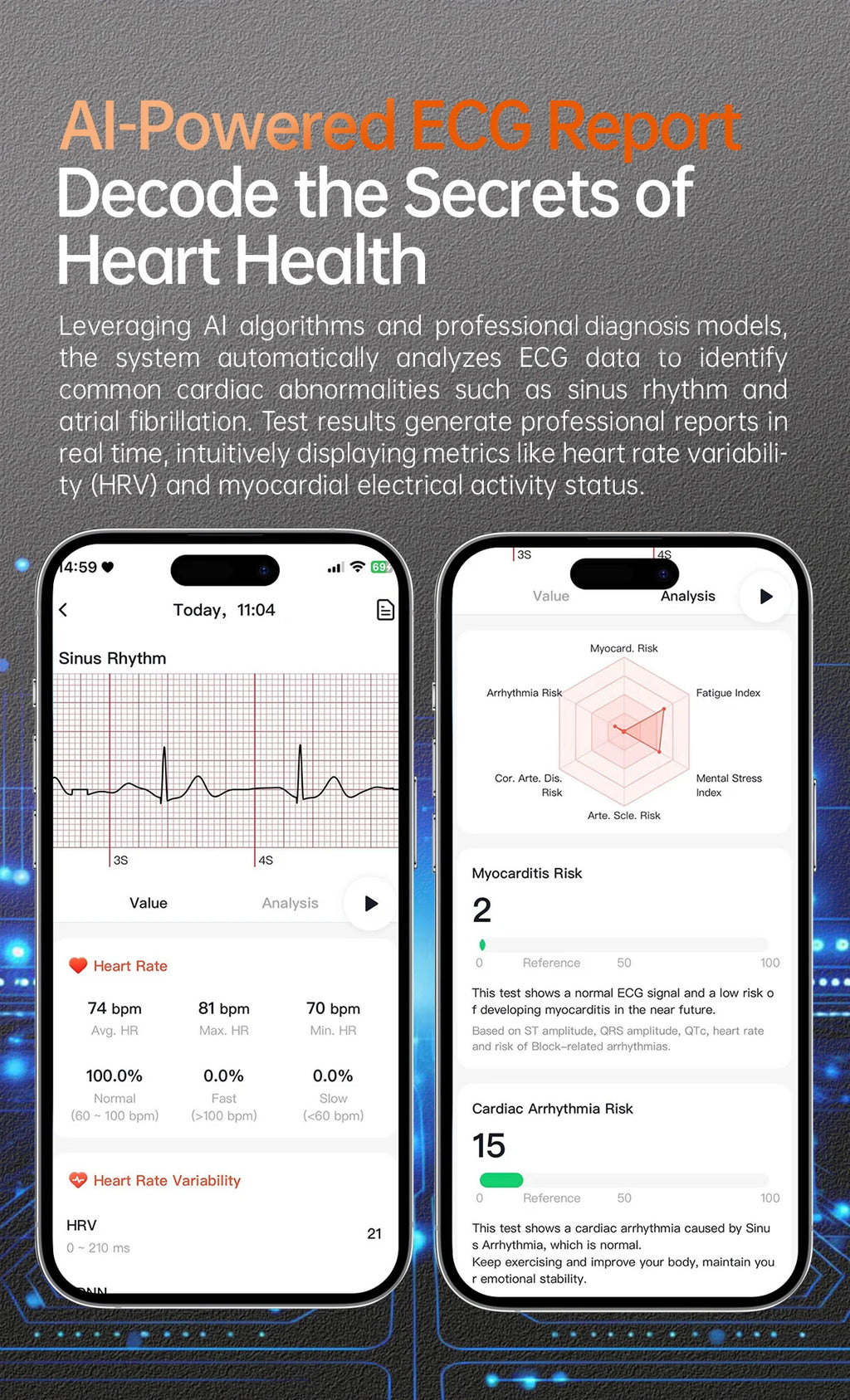 2026 New Smart Watch NFC ECG+PPG Blood oxygen Uric Acid Blood Pressure Sapphire Smartwatch Men For iPhone Android