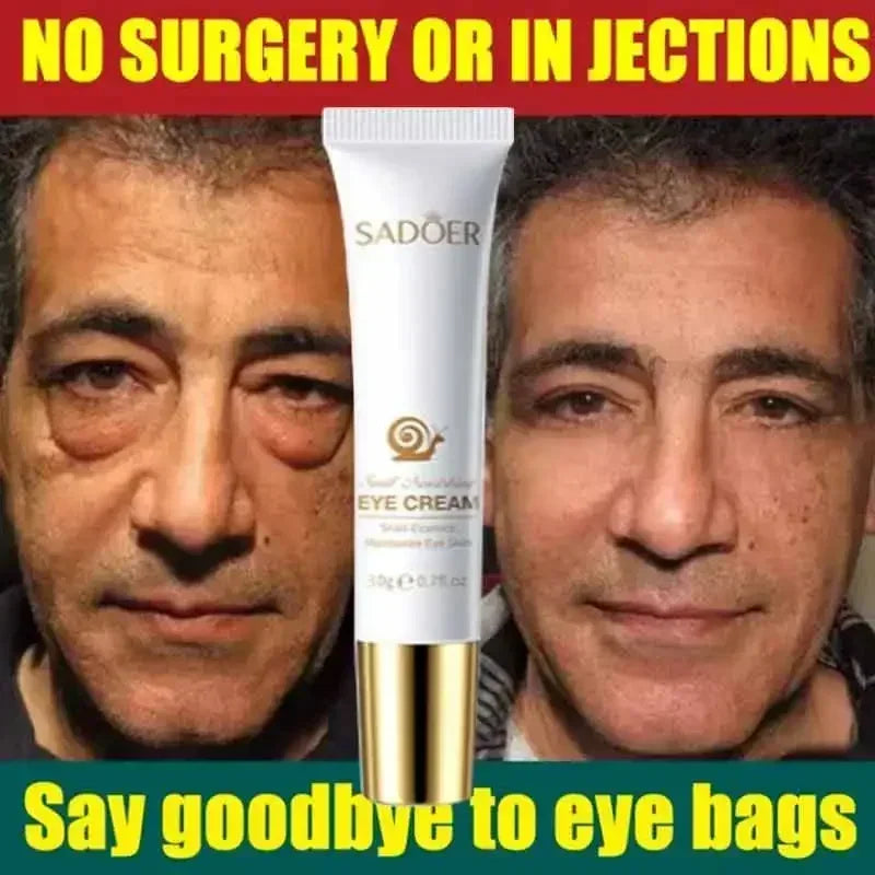 Anti Aging Eye Cream for Dark Circles & Puffiness - Tidesmit EU Scrubs Treatments Tidesmit