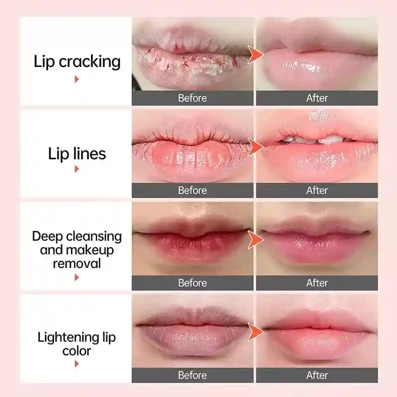 Dark Lip Lightening Balm | Exfoliating Treatment for Natural Pink Lips Lip Care Tidesmit