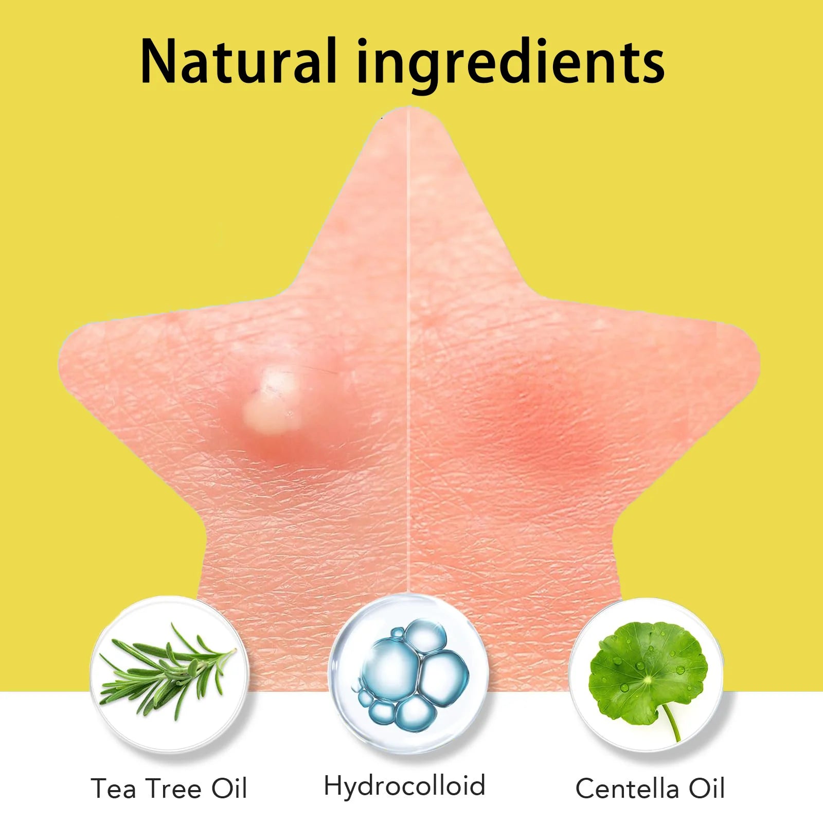 60 pieces/premium mirror acne patch, covering acne and pimple patches, deep cleansing patch, gentle and skin friendly