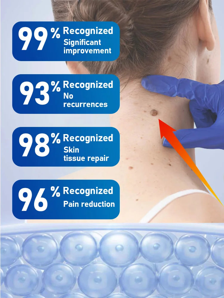 Fast Acting Wart Removal Liquid - Clinical Strength Skin Treatment Relaxation Treatment Tidesmit