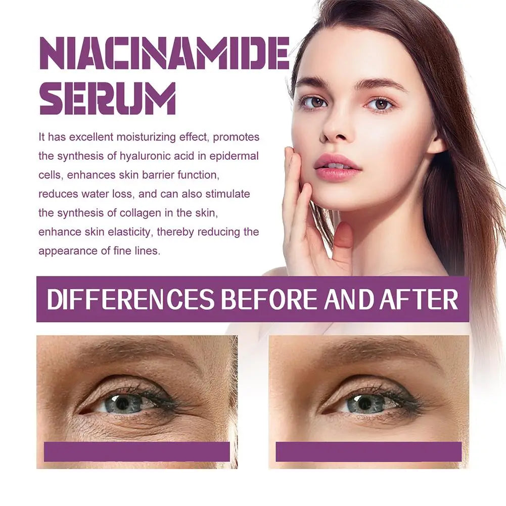 Niacinamide Serum 20% High Concentration Formula Serum Brightens Lightens Spots Niacinamide Care Serum Lifts Nasal Lines