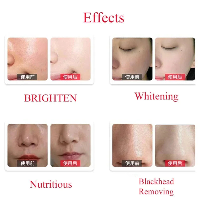 Dermabrasion Facial Serum - Hydrating Deep Cleansing 50ml Treatment Scrubs Treatments Tidesmit