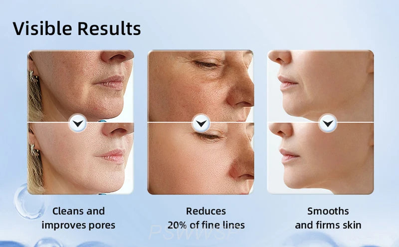 Before and after photos showing reduced pores, fewer fine lines, and smoother, firmer facial skin.