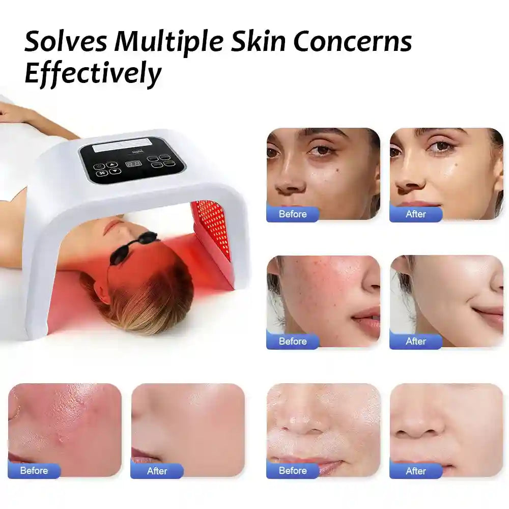 White arch-shaped LED facial light therapy machine with digital control panel, shown with before and after skin results.