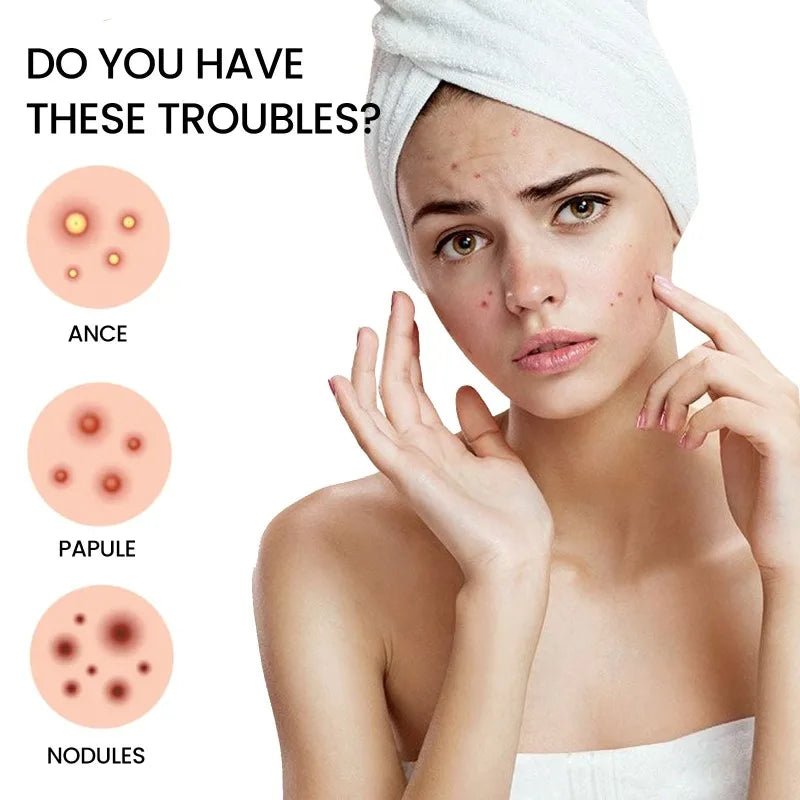 200/400pcs Acne Patches Invisible Pimple Cover for Face Oil Control Spot Treatment Cute Sticker for Covering Zits and Blemishes
