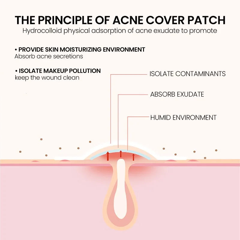 200/400pcs Acne Patches Invisible Pimple Cover for Face Oil Control Spot Treatment Cute Sticker for Covering Zits and Blemishes